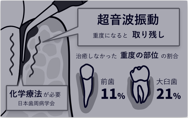 超音波振動