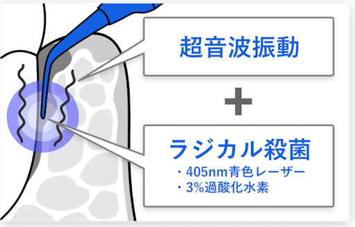 超音波振動＋ラジカル殺菌